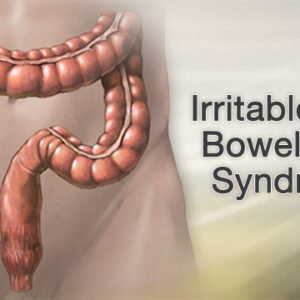 Irritable Bowel Syndrome IBS Ayurvedic Herbal Treatment