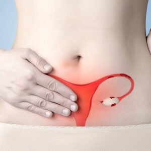 Endometriosis Natural Ayurvedic Treatment