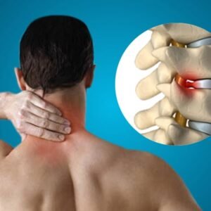 Cervical Spondylosis Ayurvedic Herbal Treatment