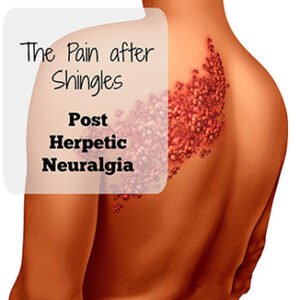 Post herpetic neuralgia PHN Ayurvedic Herbal Treatment