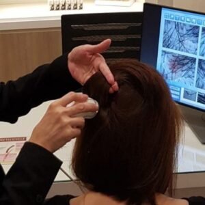 Hair and Scalp Analysis