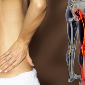 Sciatic neuritis or Sciatica Ayurvedic Herbal Treatment