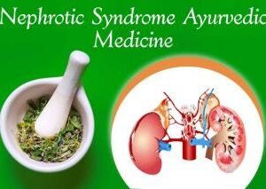 Nephrotic Syndrome Ayurvedic Herbal Treatment