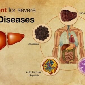 Liver Disorders Ayurvedic Herbal Treatment