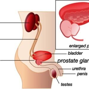 Prostate Enlagement (BPH) Ayurvedic Herbal Management