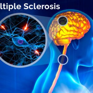 Multiple Sclerosis MS Ayurvedic Herbal Treatment